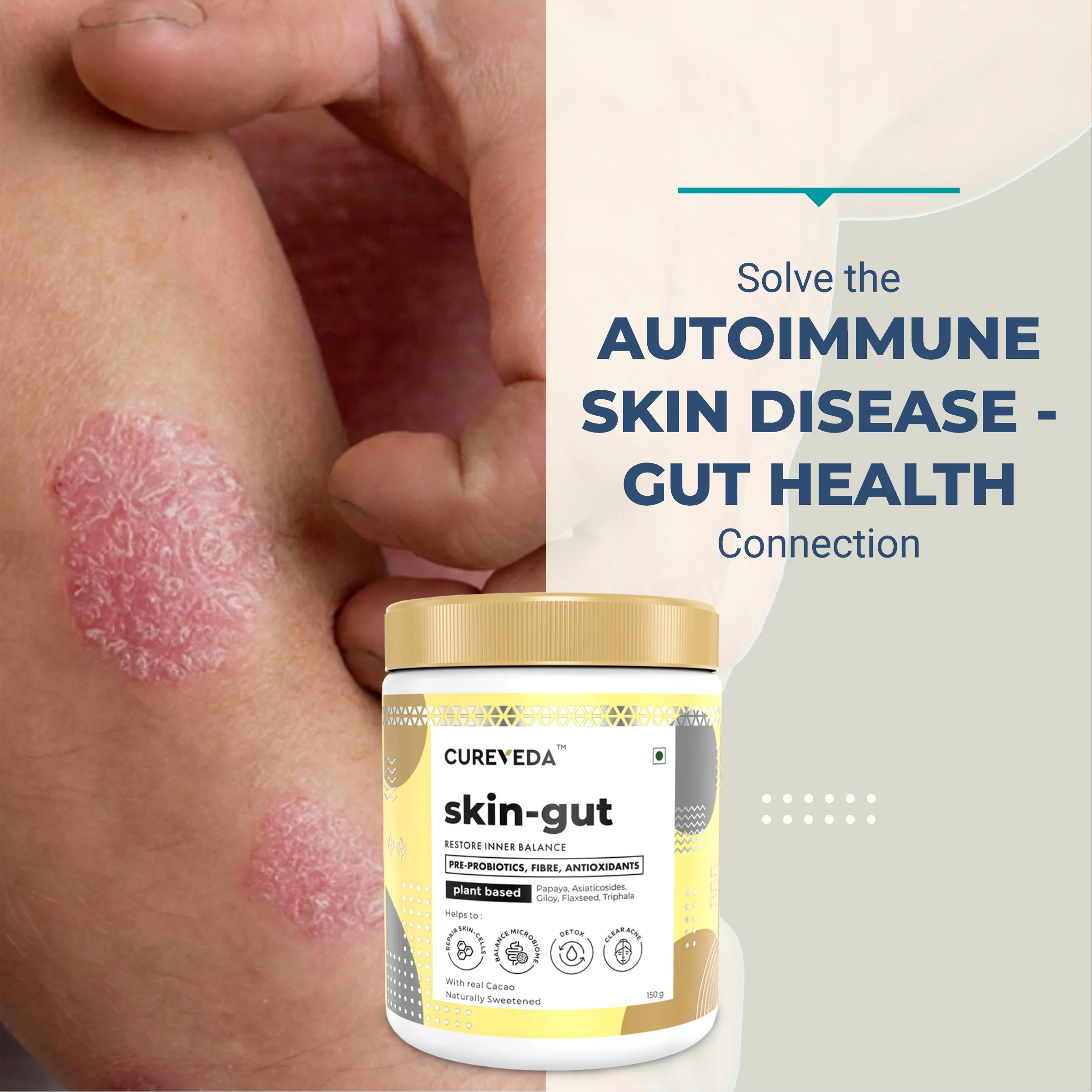 Cureveda Skin-gut with Pre-probiotics - Image 9